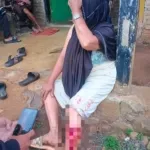 Wanita Pencari Durian Digigit Ular Piton