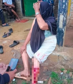 Wanita Pencari Durian Digigit Ular Piton