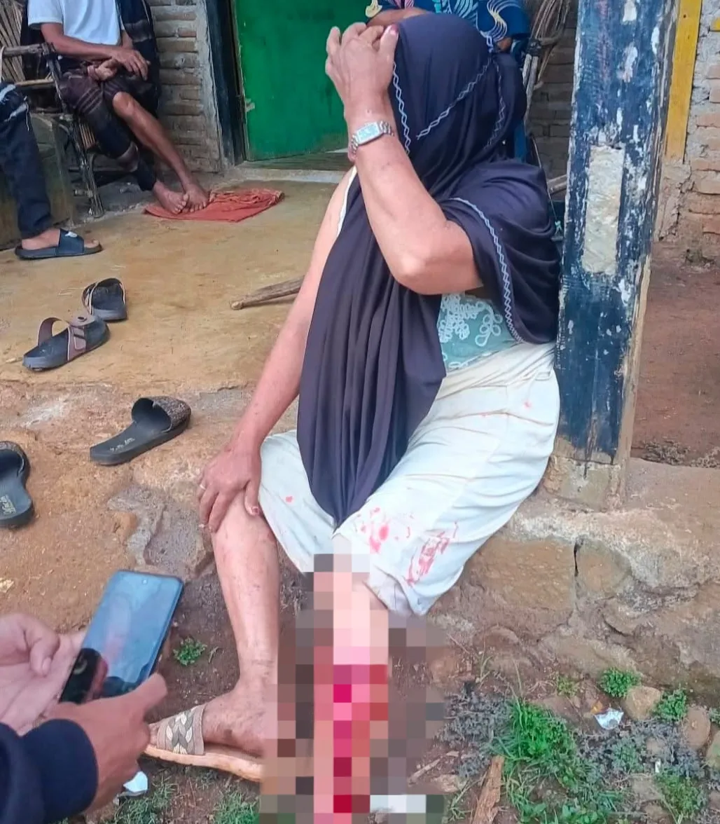 Wanita Pencari Durian Digigit Ular Piton