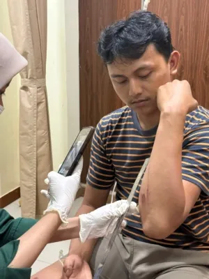 Sekretaris DPD GMNI Sulbar Jadi Korban Pengeroyokan di Mamuju